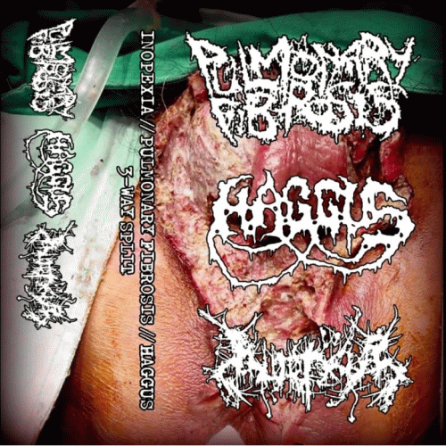 Inopexia : 3-Way Split